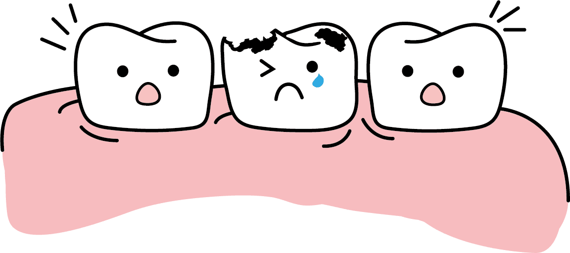 Drei comicartige Zähne im Zahnfleisch; der mittlere Zahn ist beschädigt, hat einen dunklen Fleck und schaut traurig mit einer Träne, während die beiden anderen überrascht wirken.