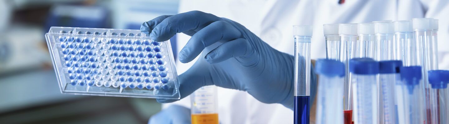 Nahaufnahme einer Person mit Handschuhen im Labor, die eine transparente Mikrotiterplatte mit blauen Proben hält; im Hintergrund stehen mehrere Reagenzgläser mit farbigen Flüssigkeiten.