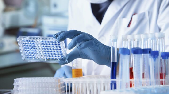 Nahaufnahme einer Person mit Handschuhen im Labor, die eine transparente Mikrotiterplatte mit blauen Proben hält; im Hintergrund stehen mehrere Reagenzgläser mit farbigen Flüssigkeiten.